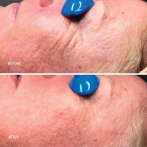 Крем-бустер HydroPeptide уникальный коллагенообразующий Nimni Cream