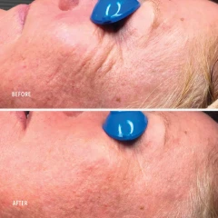 Крем-бустер HydroPeptide уникальный коллагенообразующий Nimni Cream